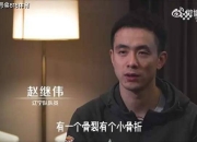 关于索恩托球员因伤将接受手术，恢复期或将长达数月的信息